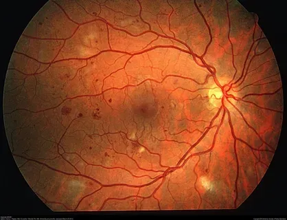 Systemic Diseases